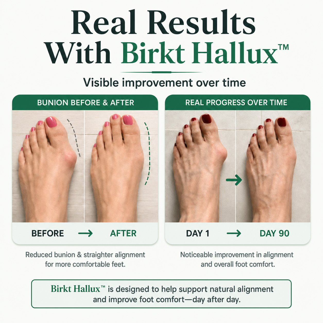 Birkt Hallux™