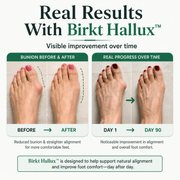 Birkt Hallux™