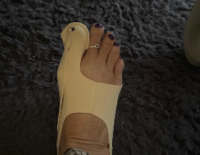 Birkt Hallux customer review