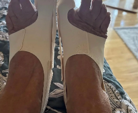Birkt Hallux customer review