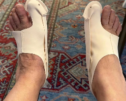 Birkt Hallux customer review